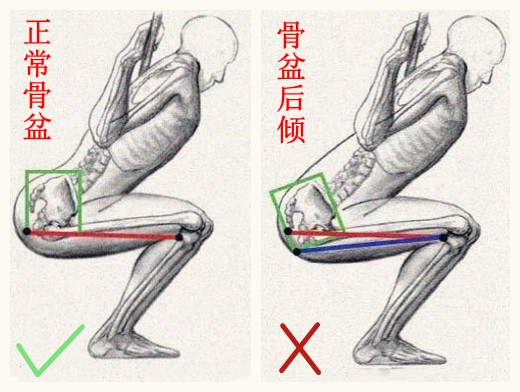 深蹲总是腰发力怎么办,深蹲总是弯腰怎么回事