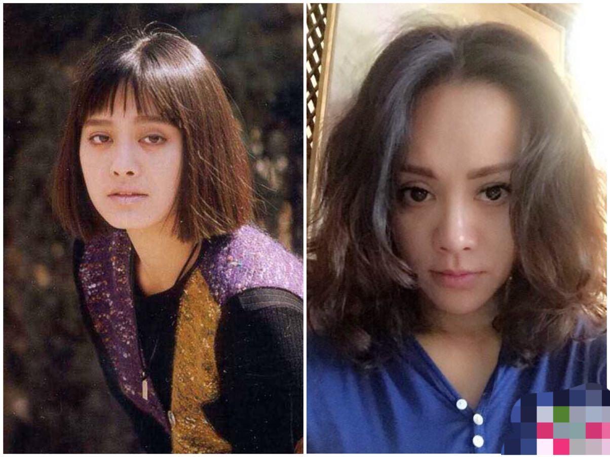 打水光针和打除皱针哪种好,打水光针和除皱针哪个好