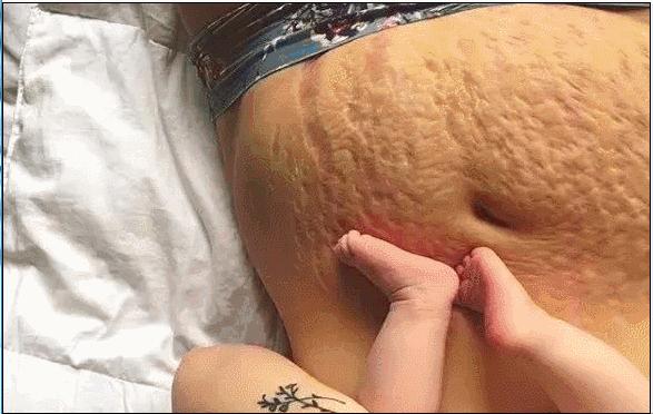 梅根产后首次公开亮相,梅根产后多久恢复身材了