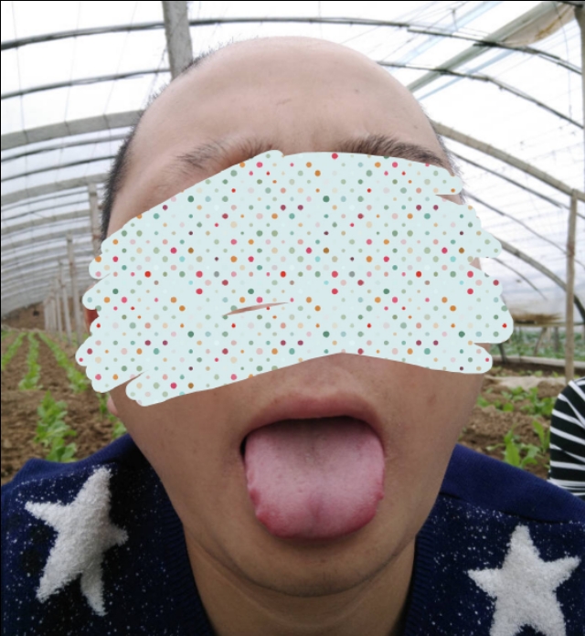 分享一些有什么解决脱发的方法吧,脱发分享