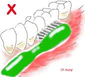 牙龈萎缩是怎么回事如何预防,预防牙龈萎缩吃什么维生素