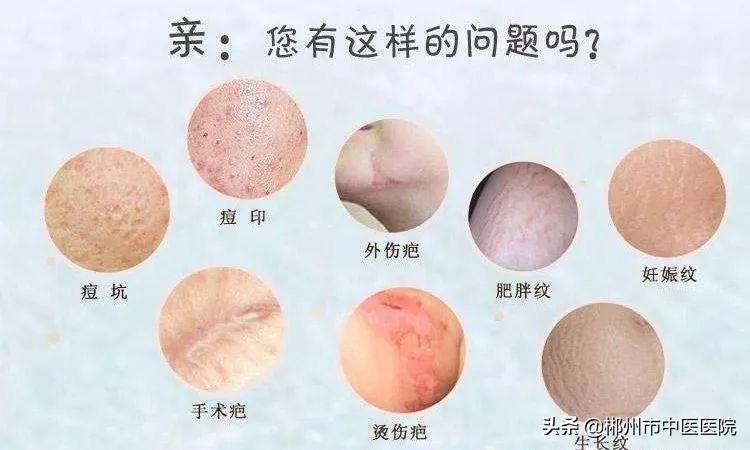 神奇的橡皮擦完整版,神奇的橡皮擦完整视频