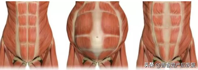 剖腹产的宝妈关心的9个大问题,值得收藏