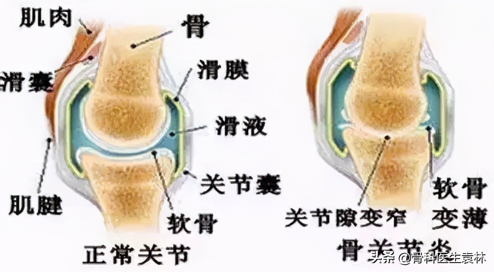 长时间走路膝关节疼怎么办,长时间站立走动膝盖疼怎么办