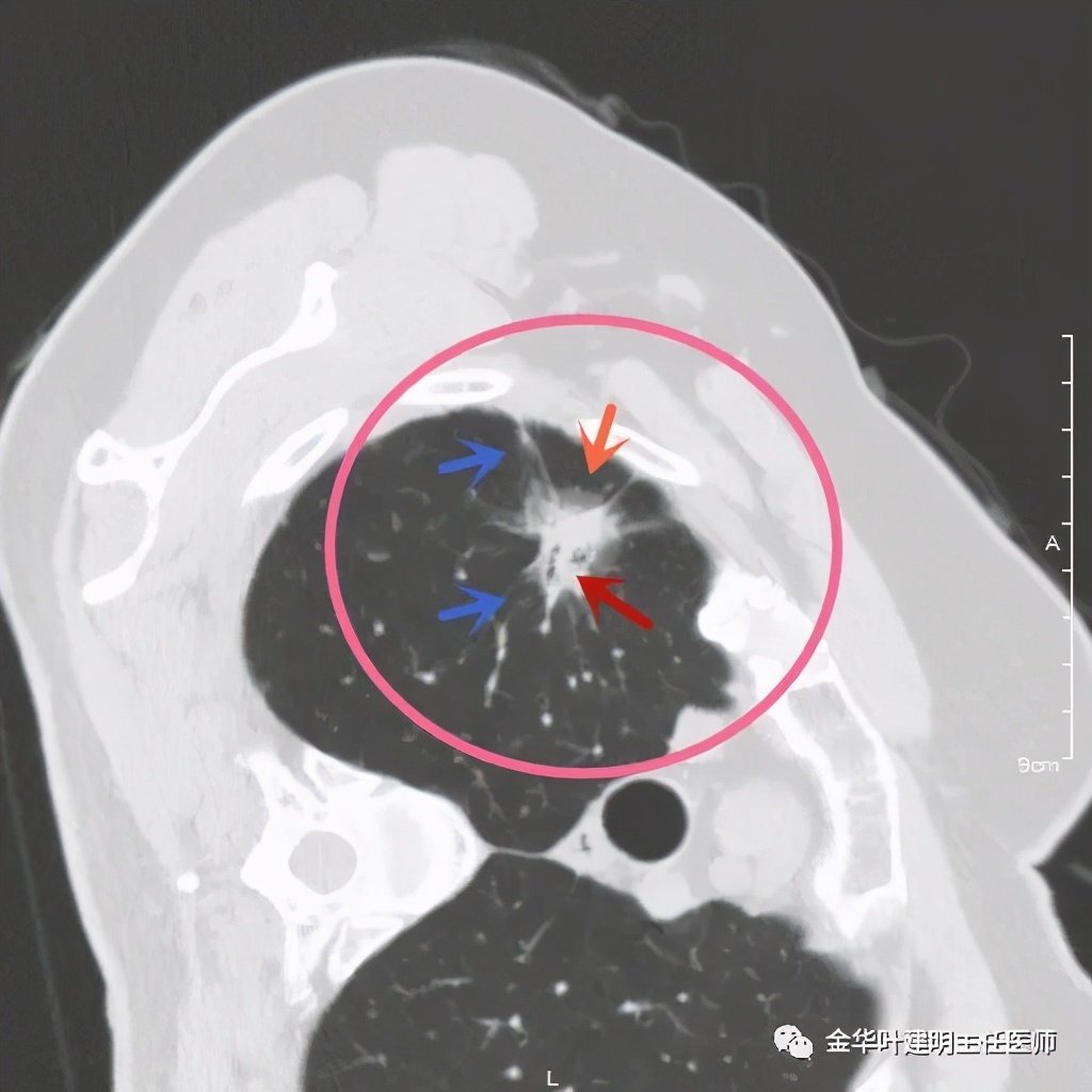 放个大招完整版教学,放个大招完整版前奏