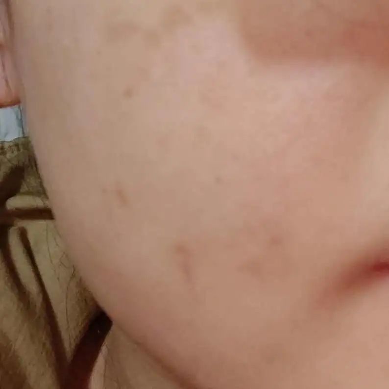 科颜氏抗初老精华露元气弹,科颜氏小白瓶跟元气弹