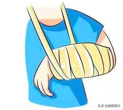 不小心摔伤骨折了怎么办,户外骨折怎么办