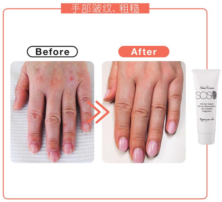 刘宇敷手膜,刘宇敷面膜视频