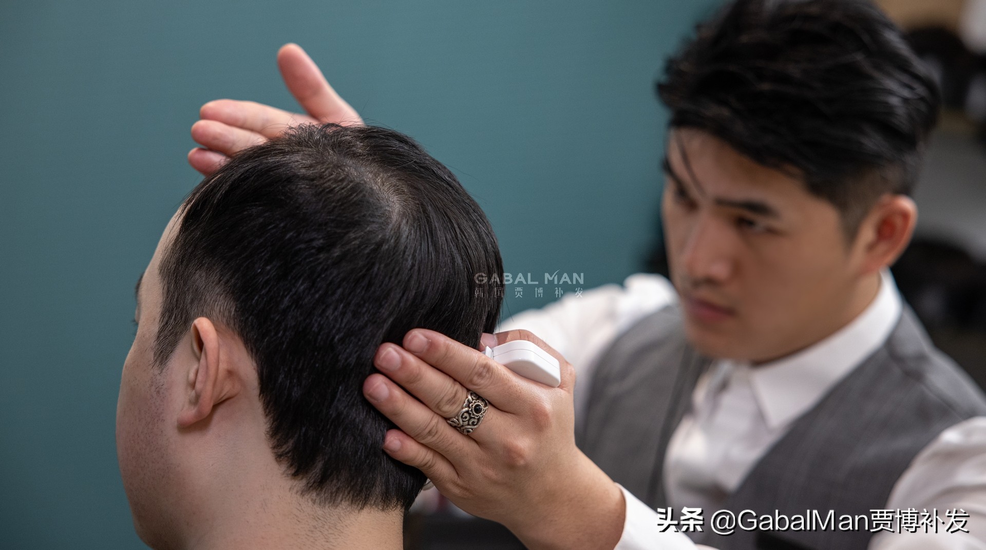 脱发不生发与身体有原因吗,脱发为什么不愿意理光头