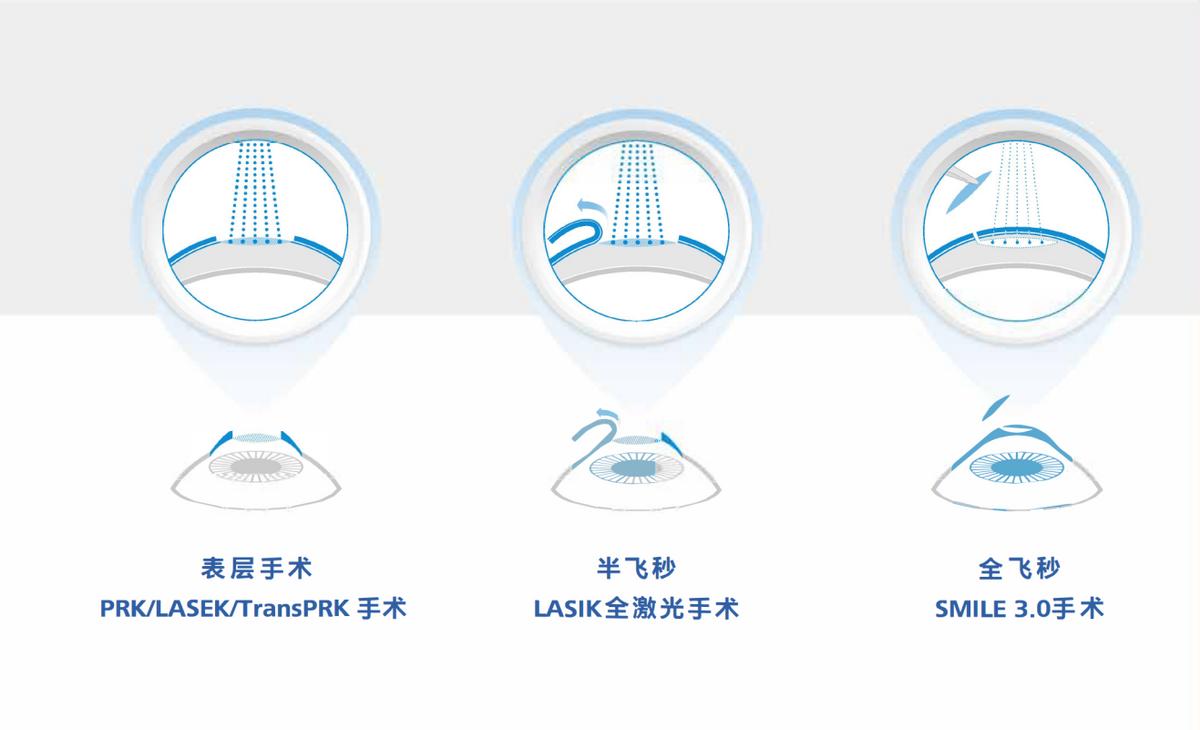 深圳市二医院急诊眼科,深圳市第二医院眼科