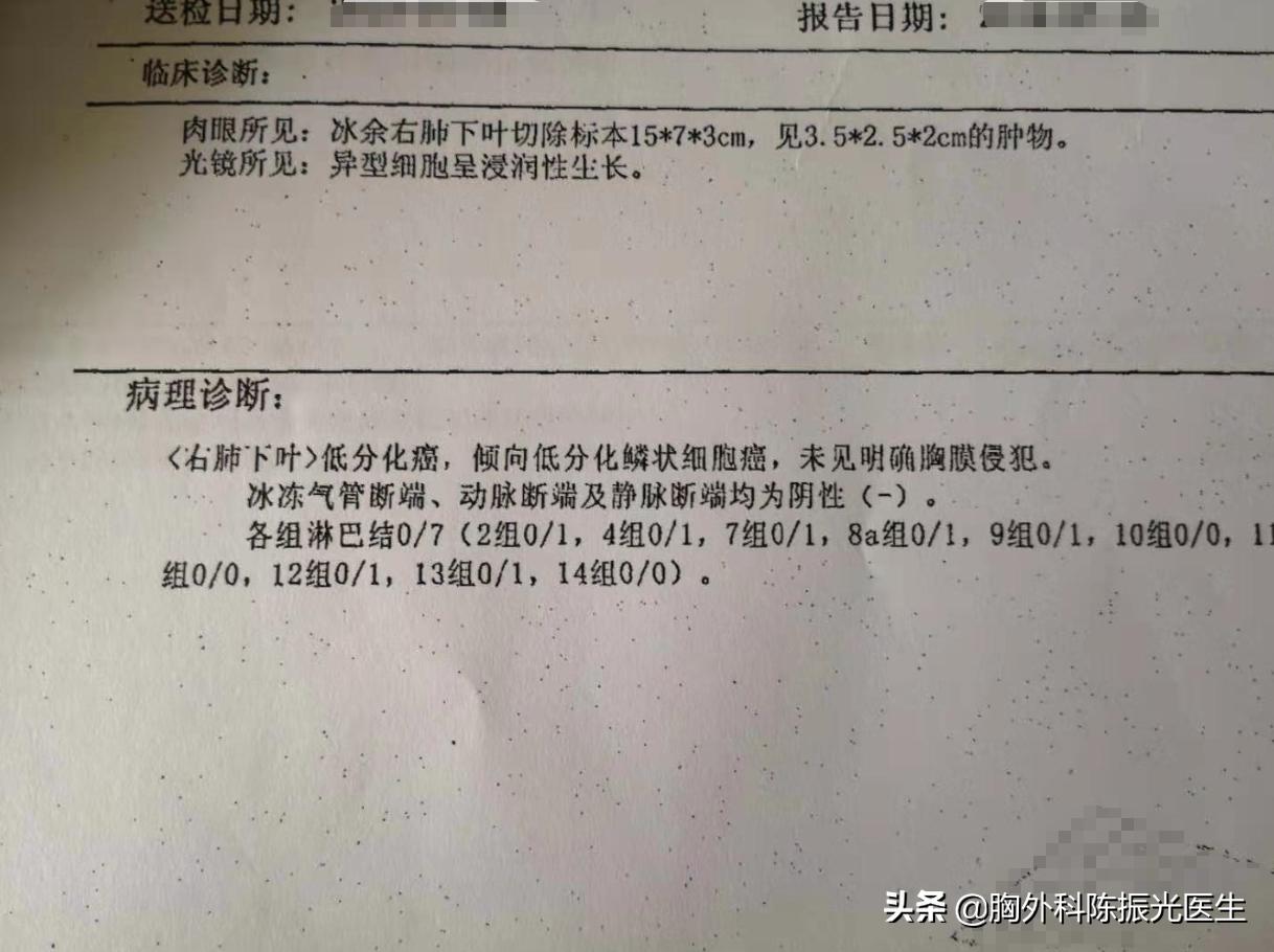病例咨询：父亲检查发现3.5厘米大的肺鳞癌，请问接下来该怎办？