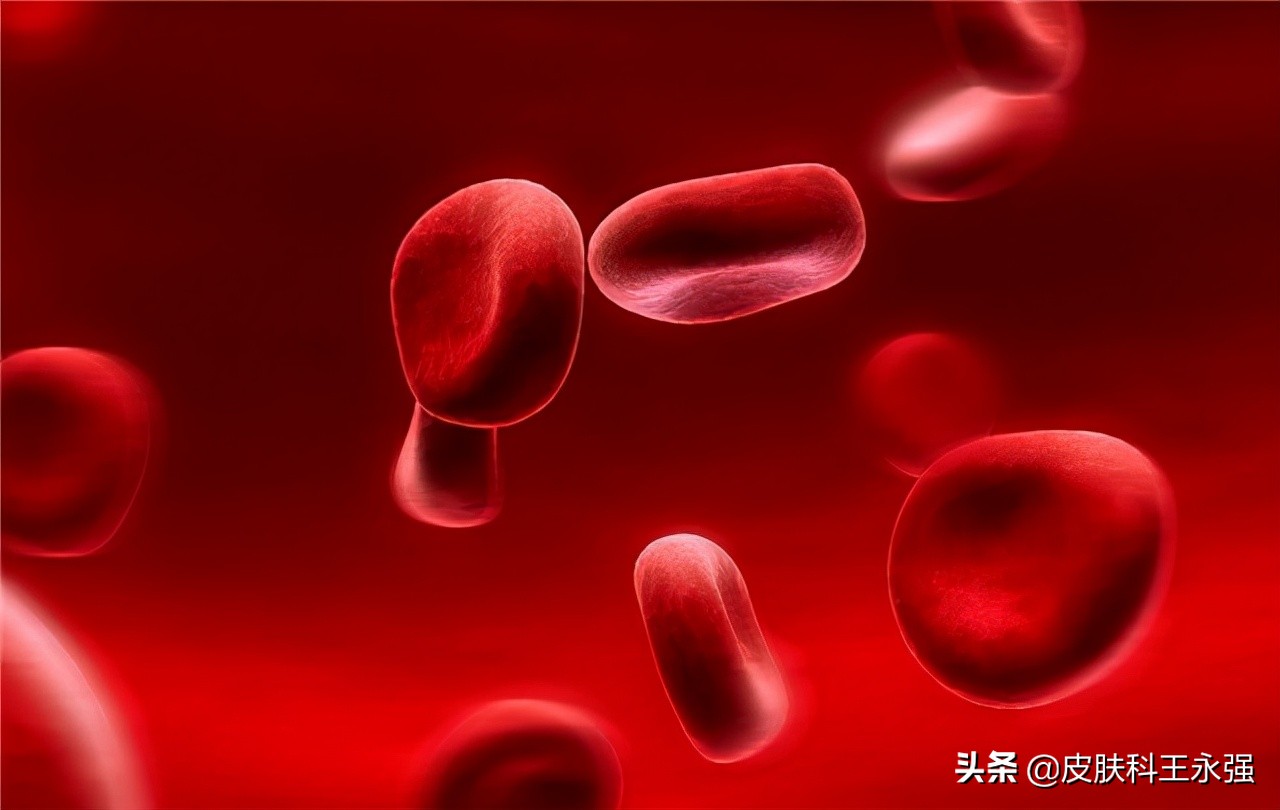 胆红素偏高会得什么病新生儿,胆红素偏高会得什么病