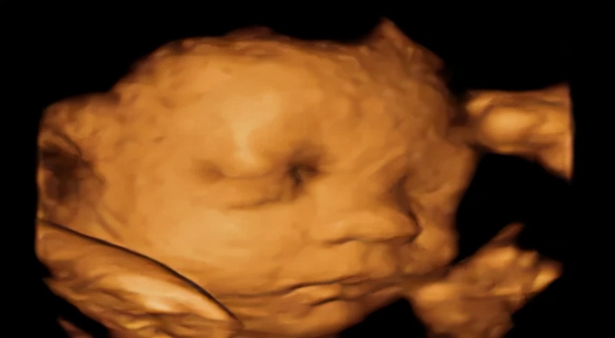 孕期超声检查须知,准妈妈必读产前超声小课堂