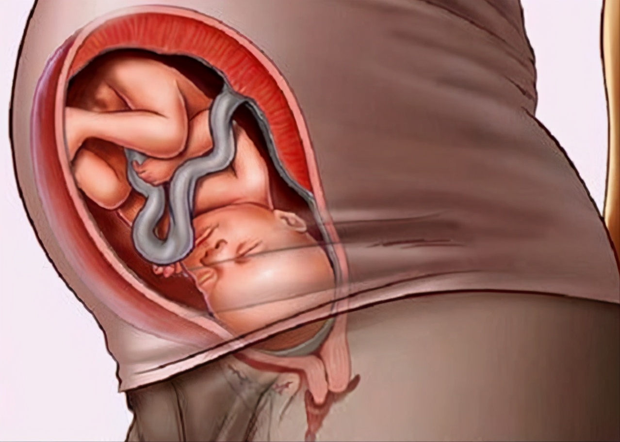 孕晚期宝宝头朝下是入盆了吗,孕晚期宝宝一般在多少周胎头朝下