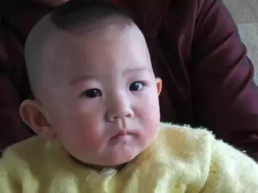 湿疹反反复复如何治疗不用激素药,孕妈妈得了湿疹之后应当如何治疗