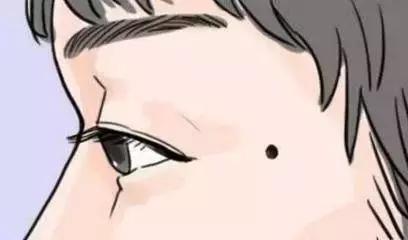 黑痣要去掉吗?专家和你聊聊关于“黑痣”的那些事儿