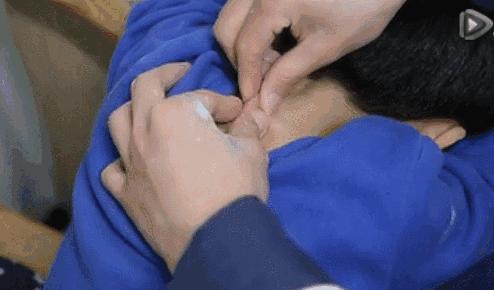 小儿推拿如何让孩子学会,2020小儿推拿常见病辨证思路