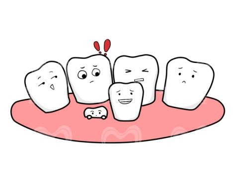 如何判断牙齿拥挤程度,牙齿拥挤对脸型的影响