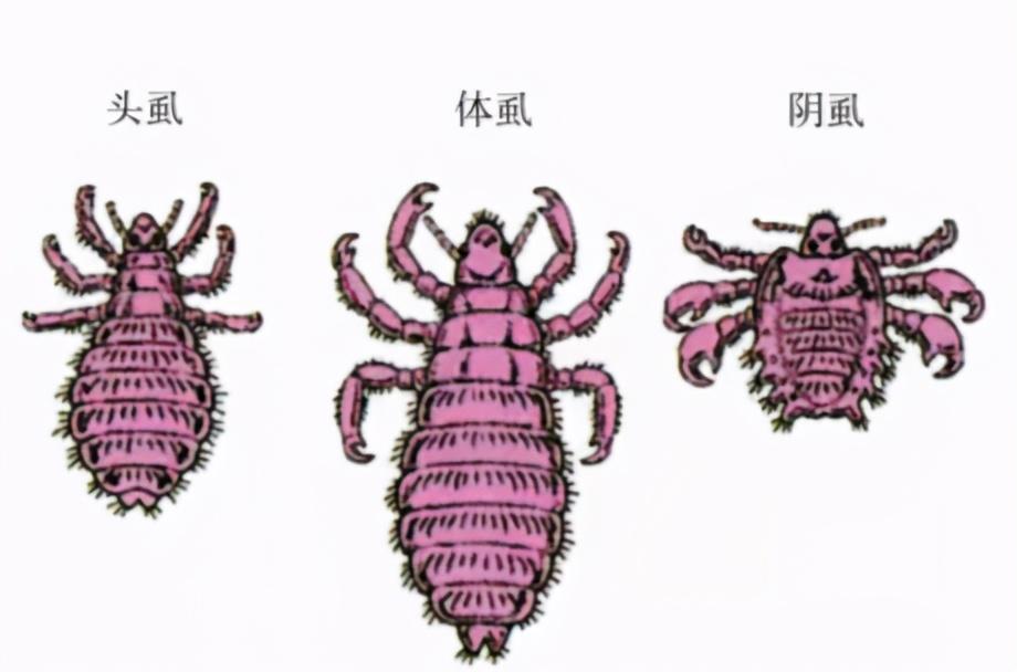 小孩睫毛长阴虱什么症状,6岁女童眼睫毛长虱子