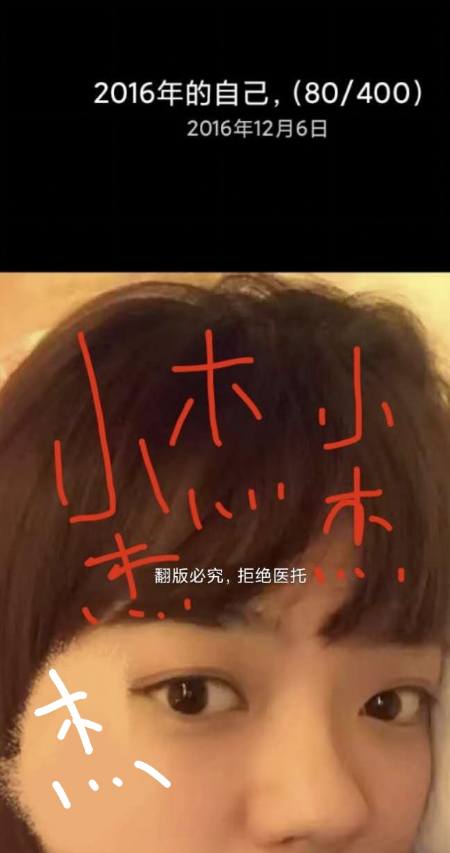 长沙隆鼻1-7天恢复过程图,长沙做假体隆鼻手术多少钱