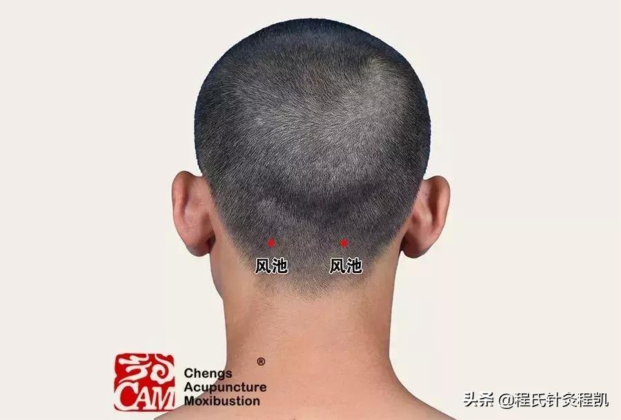 颈肩综合症的七大症状,颈肩并发症该如何治疗