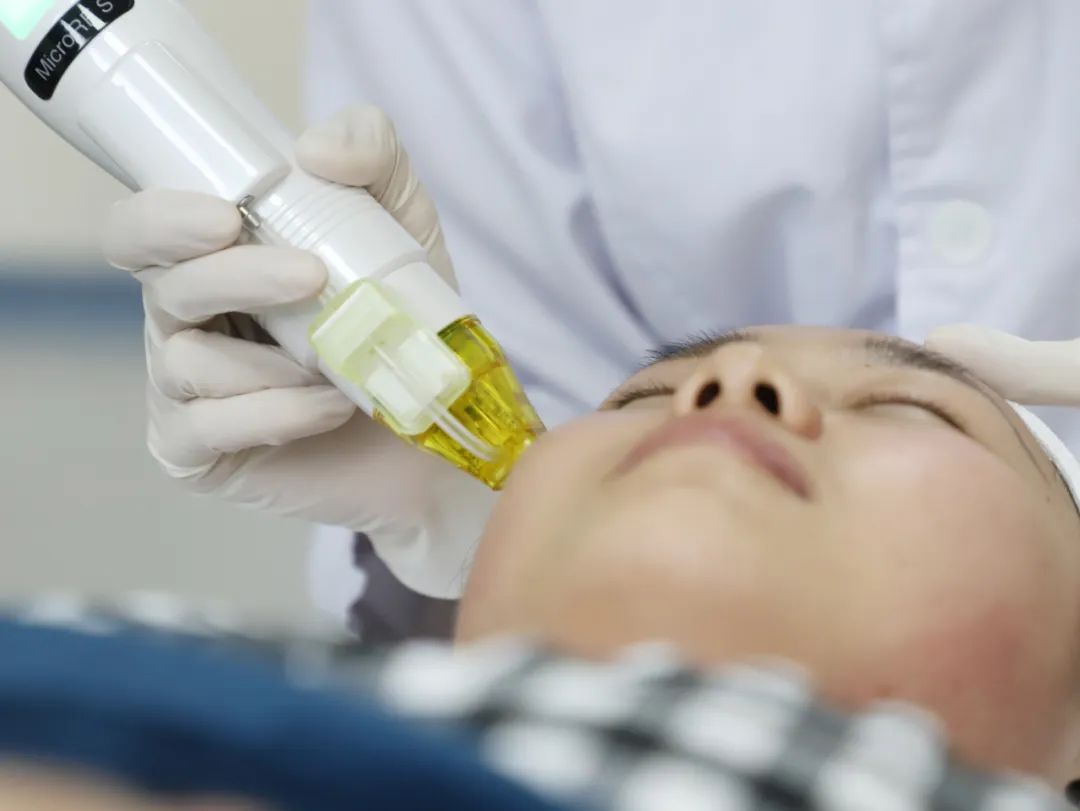 妊娠纹皱纹去除最好的办法,抗皱的护肤品可以祛妊娠纹吗