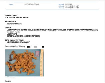 疫情下土澳的留学生,疫情下的中国留韩学生