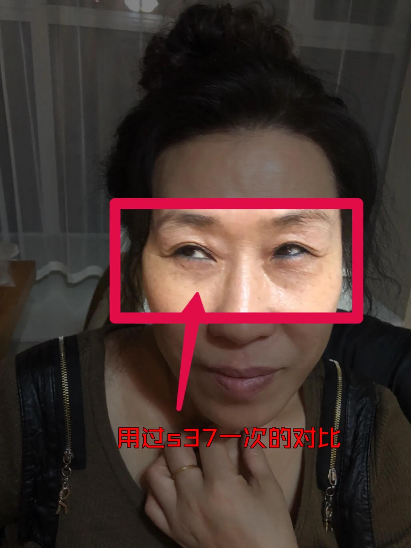 s37微雕眼好用吗,s37微雕眼部套
