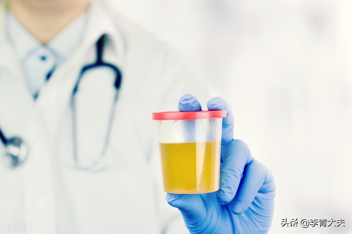 世界肾脏日：尿蛋白的检测方法有哪些？