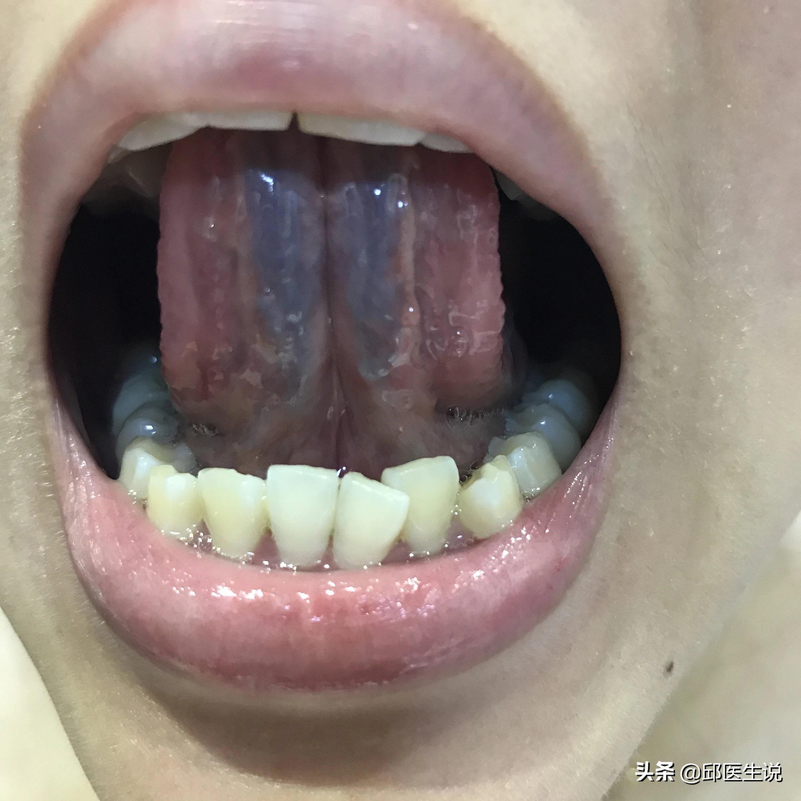 每月月经血量一般是多少,每个月流血过多