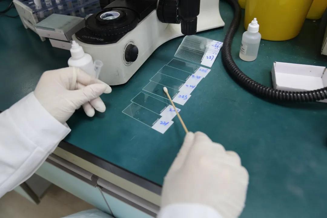 妇幼保健院的白带常规报告解读,妇幼保健院能查白带常规么