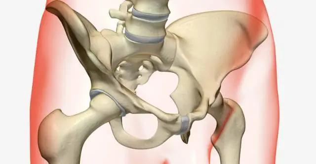 生完孩子后有肉块出来,生完孩子子宫外侧多了块肉是什么