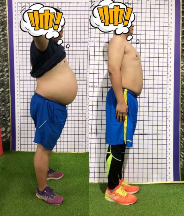 内脏脂肪厚的大肚腩,内脏脂肪导致的大肚腩