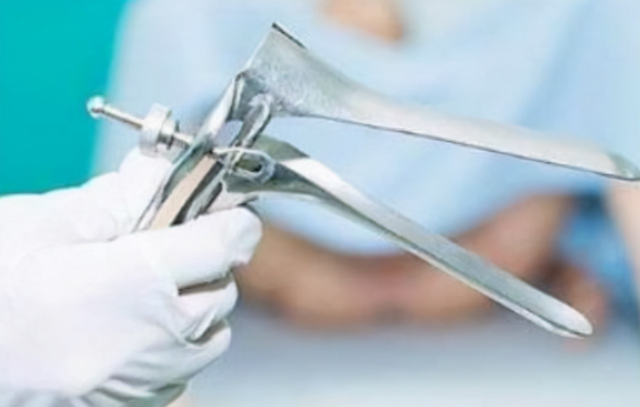 女生必查的妇科检查,妇科尴尬的检查有哪些