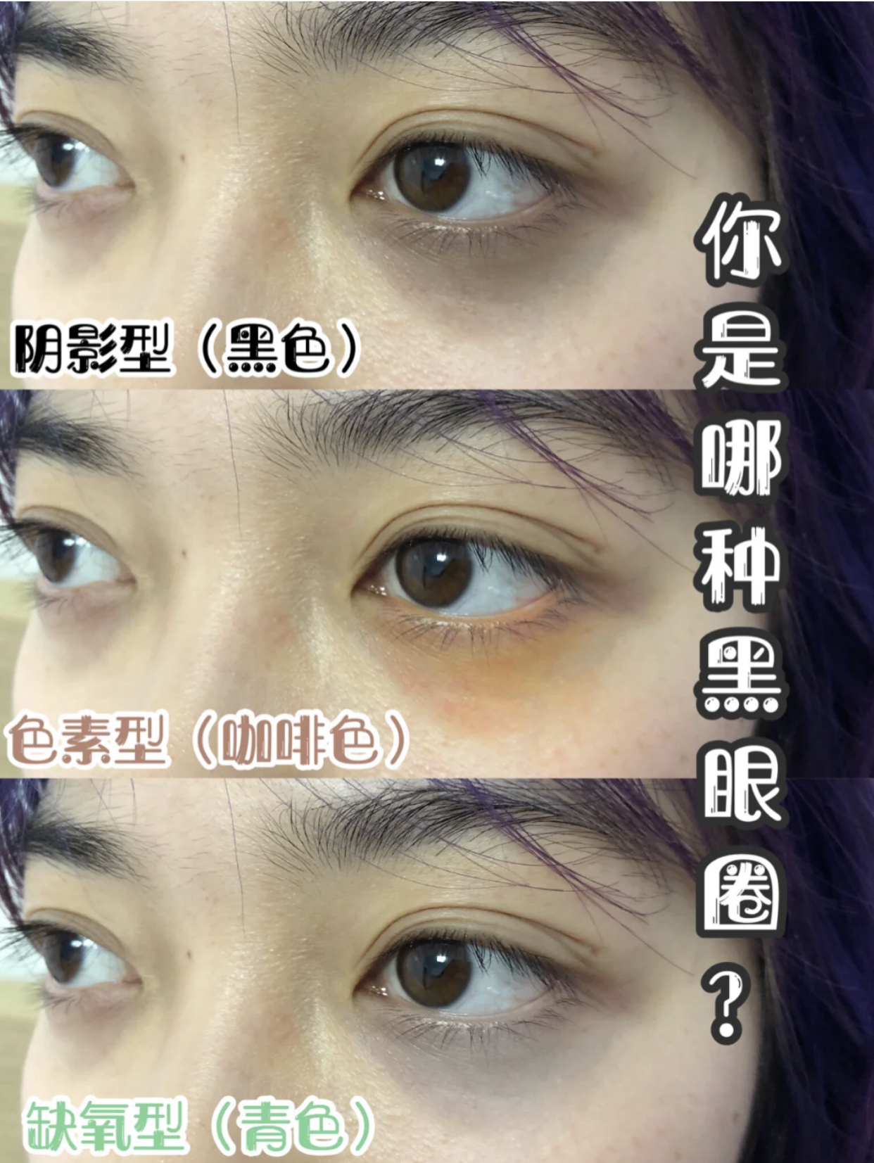 分享帖|越用越严重?微信代购热卖的那些爆款眼霜,到底怎么回事