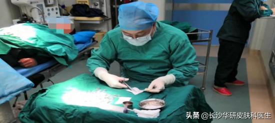 白癜风怎么治疗最快最见效,白癜风的治疗方法怎么治