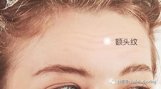 法令纹额头纹眼角纹怎么去除,额头纹抬头纹要怎么消除