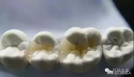 小小牙齿,小小牙齿矫正