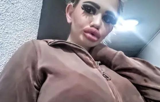 20次丰唇,20次整容成功的女人