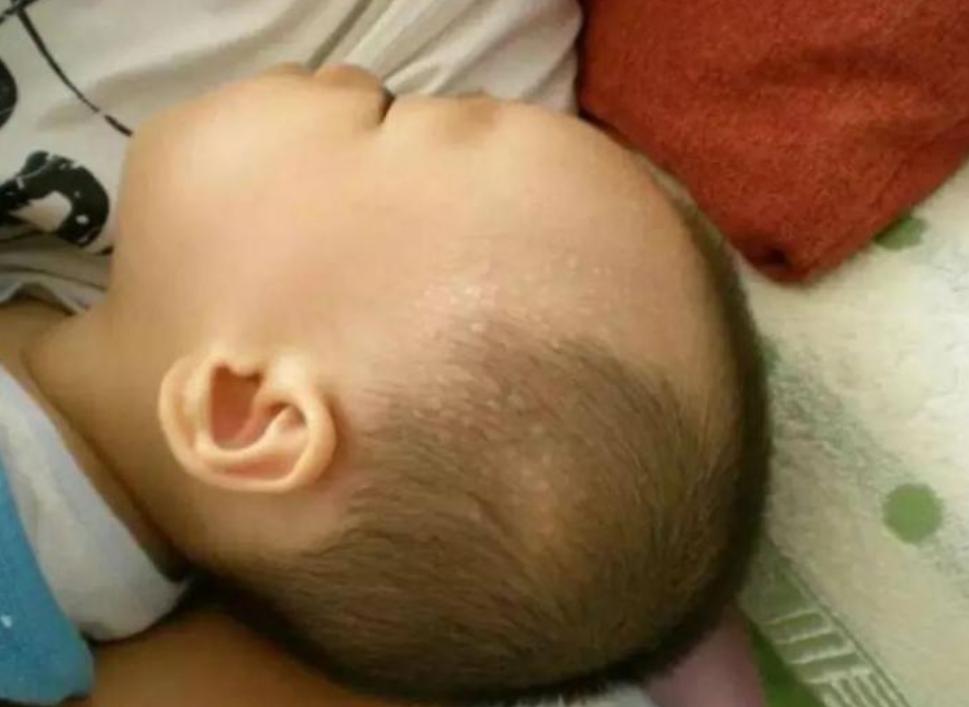 孩子一睡着就满头大汗是缺钙吗,婴儿睡着一头大汗是缺钙吗