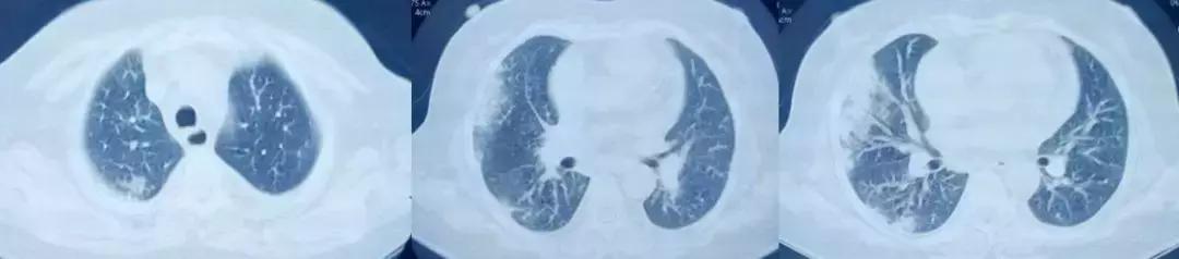 抗菌药物不合理处方分析,抗菌药物用药不合理的表现