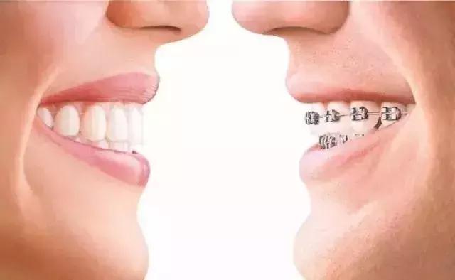 helen鐗欑涓績鍥剧墖,寰峰浗鐗欑姝g暩