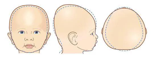 小孩头睡歪了用什么方法调整,婴儿头往右边歪应该朝哪边睡