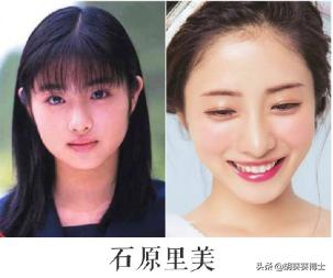 日本整容失败面目全非的10大女星,日本整容最成功的女星