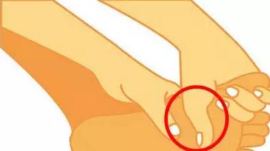 扁平足穿什么鞋都痛吗,扁平足穿什么鞋可以矫正