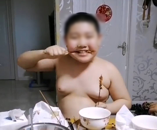 孩子虚胖是什么原因,儿子胸部肥胖怎么解决