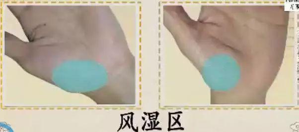 手的10大疾病征兆,手诊10种常见病从手上就能看出来