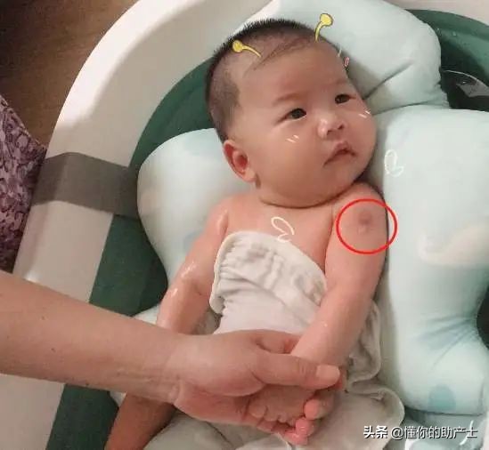 胳膊上莫名其妙的长疤怎么来的,胳膊上长的像疤一样的东西是什么