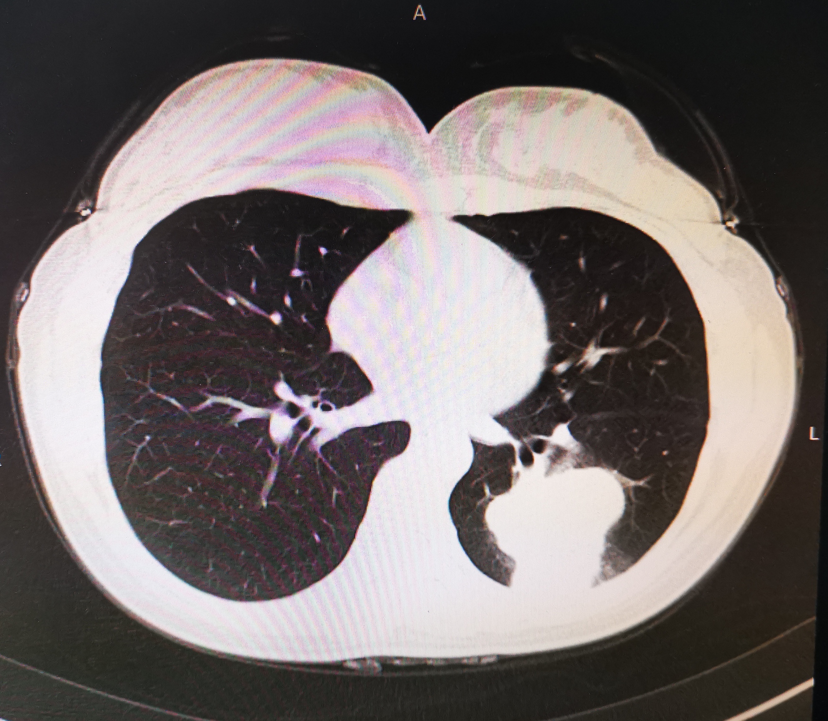 一个癌症患者的自我剖析,一个肿瘤外科医生的反思