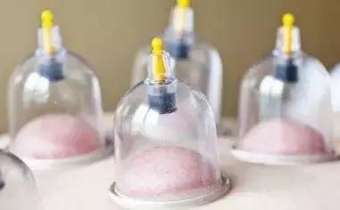 拔罐最高境界是什么,拔罐是东方神起还是伪科学